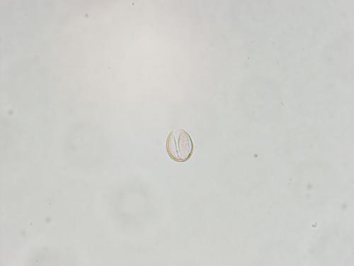 B 14